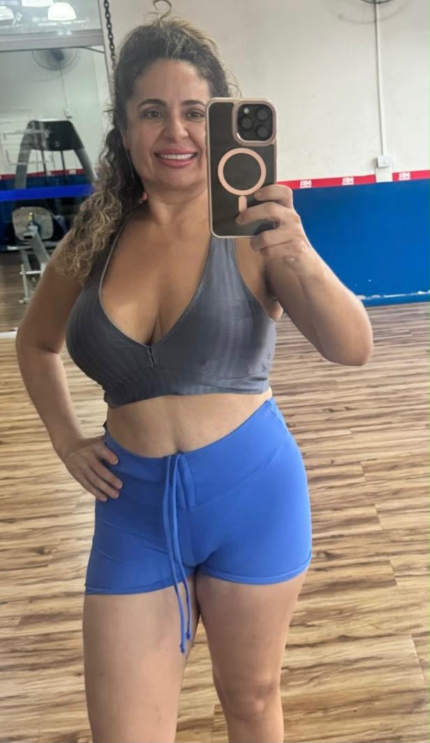 Eliene — antes do acompanhamento com Dr. Rodrigo Costta