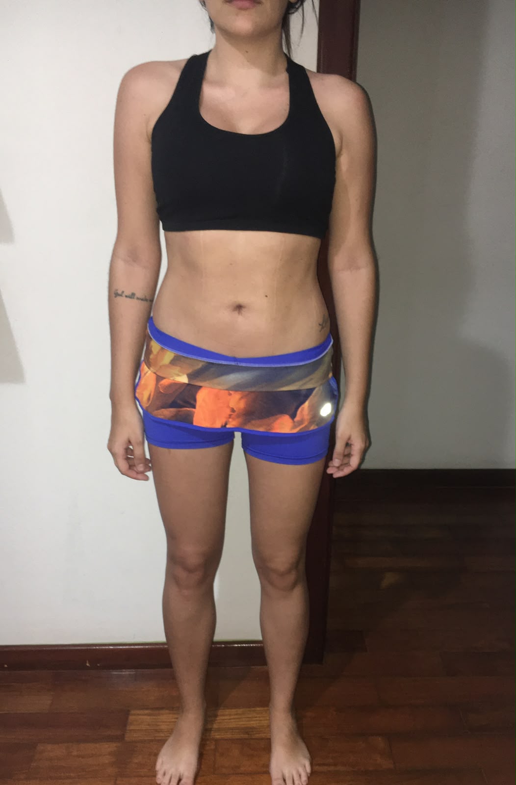 Palomah — antes do acompanhamento com Dr. Rodrigo Costta